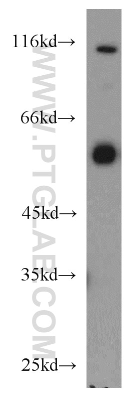 WB analysis of mouse brain using 55186-1-AP