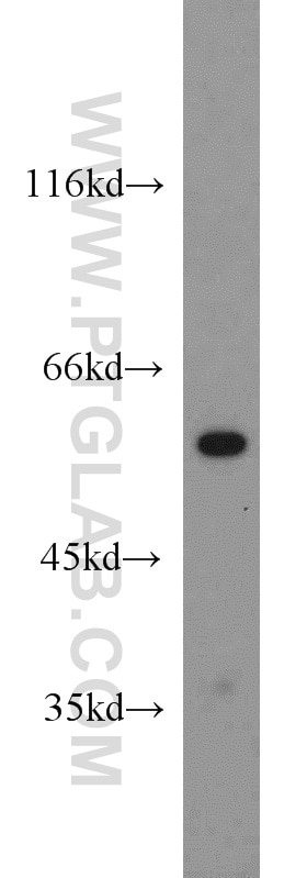 Western Blot (WB) analysis of mouse skeletal muscle tissue using PTBP2 Polyclonal antibody (55186-1-AP)