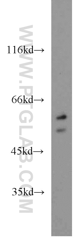 Western Blot (WB) analysis of mouse skeletal muscle tissue using PTBP2 Polyclonal antibody (55186-1-AP)