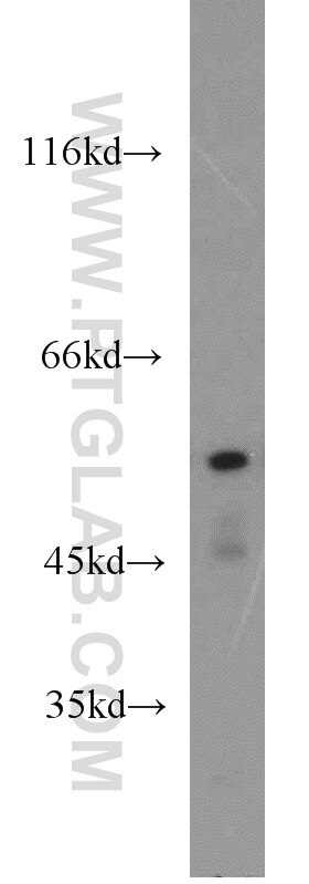 Western Blot (WB) analysis of mouse heart tissue using PTBP2 Polyclonal antibody (55186-1-AP)