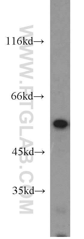 Western Blot (WB) analysis of mouse heart tissue using PTBP2 Polyclonal antibody (55186-1-AP)