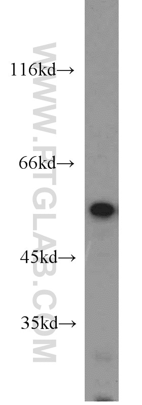 WB analysis of mouse heart using 55186-1-AP