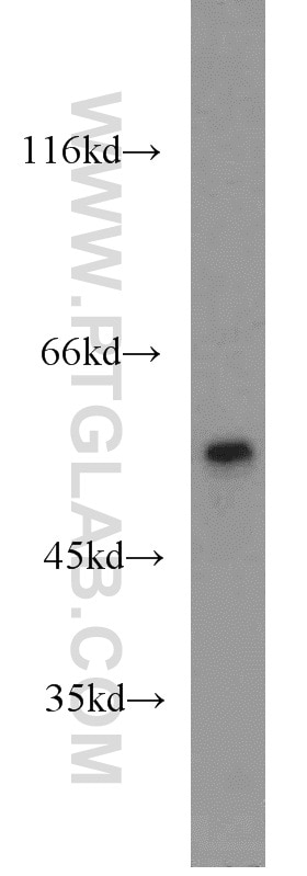 Western Blot (WB) analysis of mouse heart tissue using PTBP2 Polyclonal antibody (55186-1-AP)