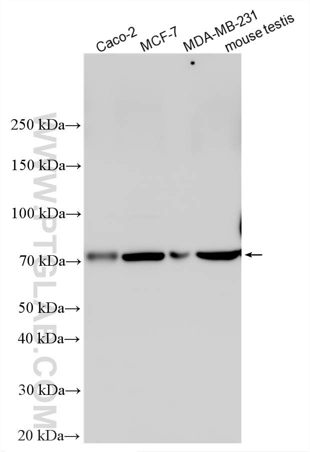 WB analysis using 33057-1-AP Western Blot (WB) analysis of various lysates using PTCD1 Polyclonal antibody (33057-1-AP)