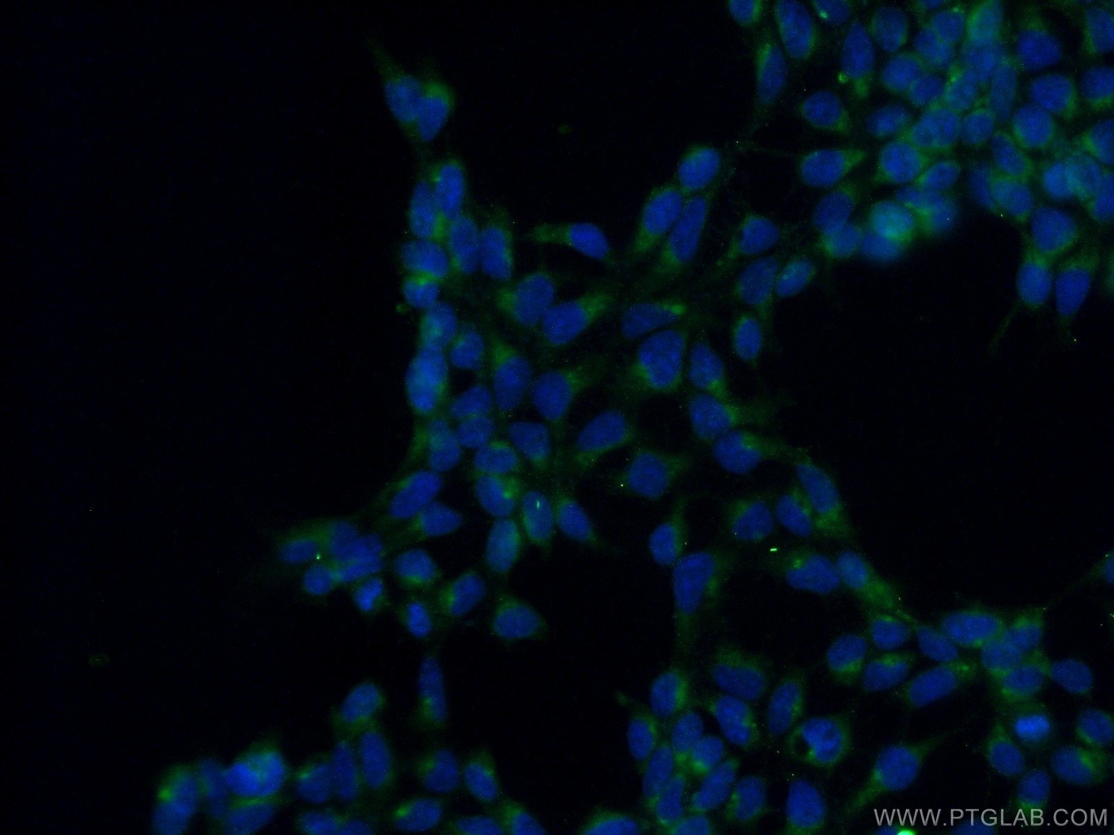 Immunofluorescence (IF) / fluorescent staining of HEK-293 cells using PTCD3 Polyclonal antibody (25158-1-AP)