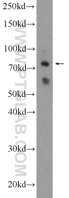 Western Blot (WB) analysis of rat kidney tissue using PTCD3 Polyclonal antibody (25158-1-AP)