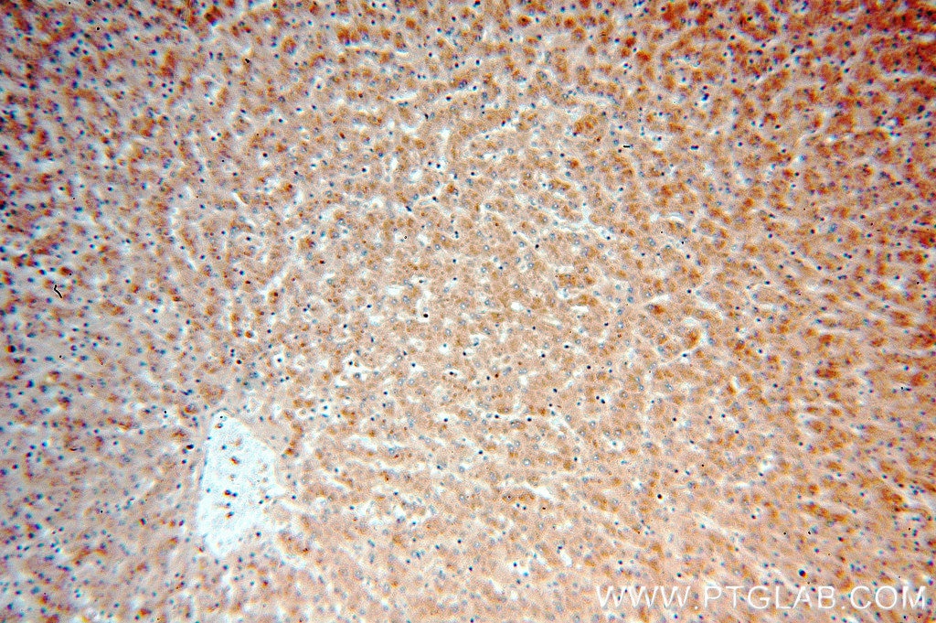 Immunohistochemistry (IHC) staining of human liver tissue using PTCH1 Polyclonal antibody (17520-1-AP)