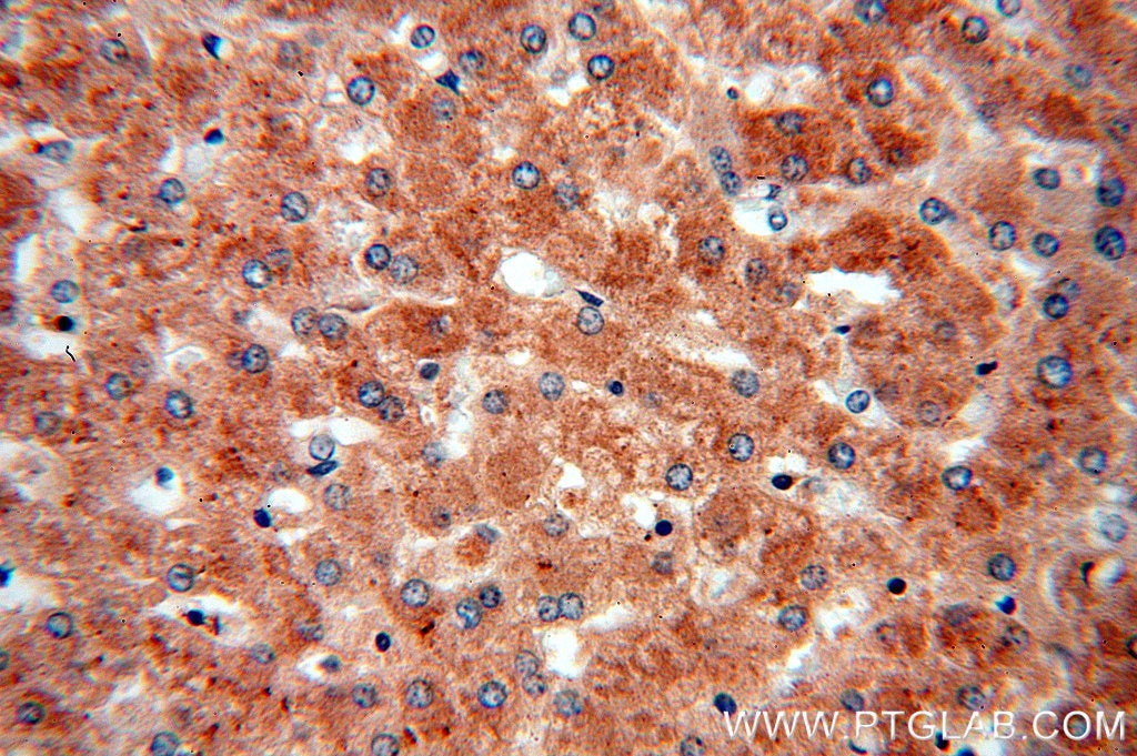 Immunohistochemistry (IHC) staining of human liver tissue using PTCH1 Polyclonal antibody (17520-1-AP)