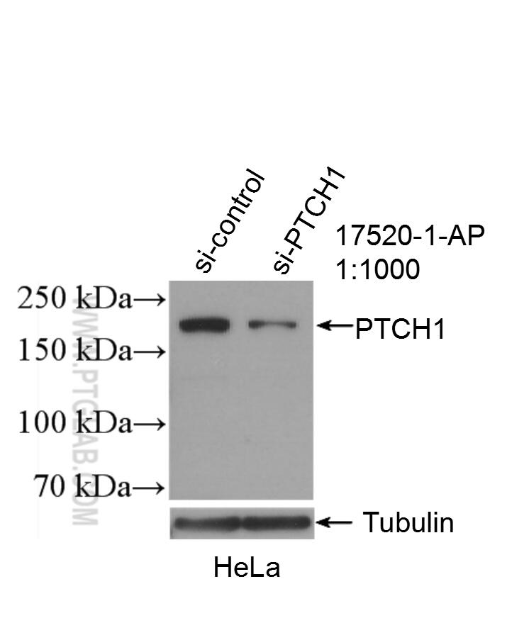 Western Blot (WB) analysis of HeLa cells using PTCH1 Polyclonal antibody (17520-1-AP)