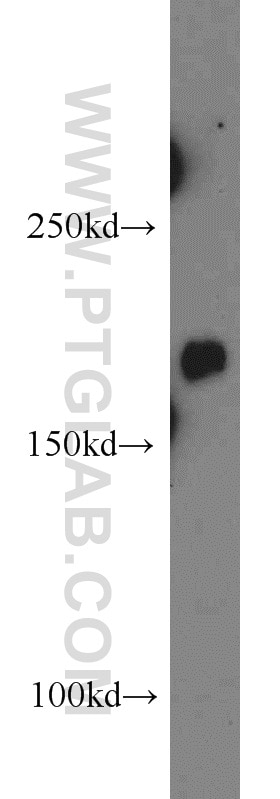 Western Blot (WB) analysis of mouse brain tissue using PTCH1 Polyclonal antibody (17520-1-AP)