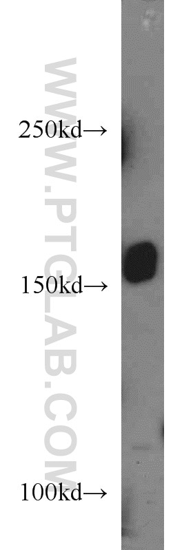 Western Blot (WB) analysis of A431 cells using PTCH1 Polyclonal antibody (17520-1-AP)