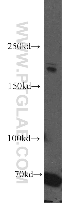 Western Blot (WB) analysis of HeLa cells using PTCH1 Polyclonal antibody (17520-1-AP)