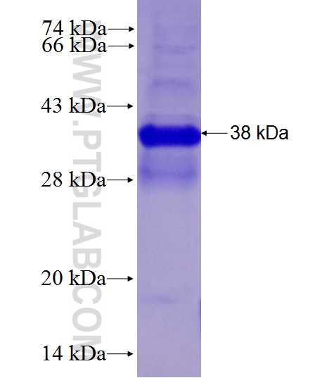 PTCH1 fusion protein Ag28093 SDS-PAGE