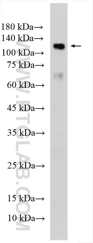 Western Blot (WB) analysis of mouse liver tissue using PTCH2 Polyclonal antibody (55091-1-AP)