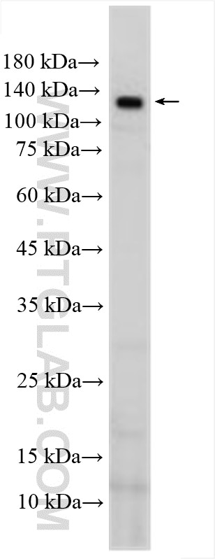 Western Blot (WB) analysis of rat liver tissue using PTCH2 Polyclonal antibody (55091-1-AP)