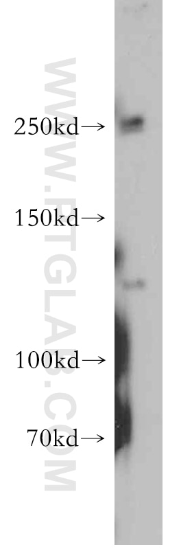 WB analysis of human brain using 55091-1-AP