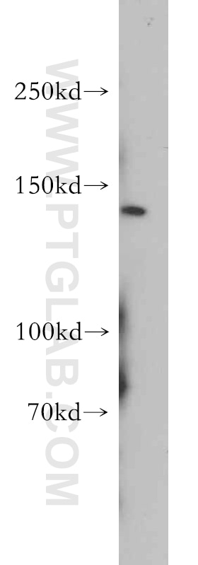 Western Blot (WB) analysis of HepG2 cells using PTCH2 Polyclonal antibody (55091-1-AP)