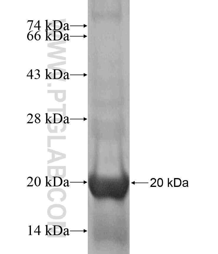 PTCHD3 fusion protein Ag17333 SDS-PAGE