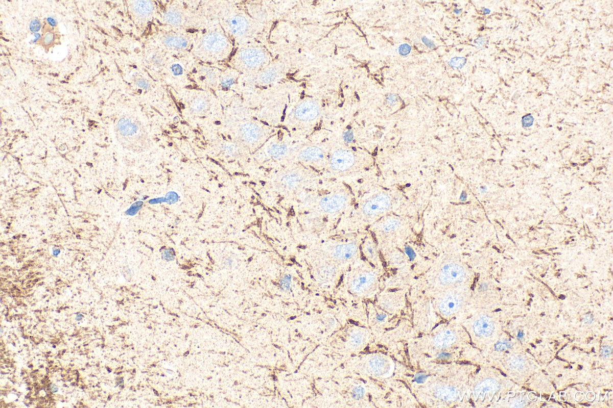IHC staining of rat brain using 33489-1-AP (same clone as 33489-1-PBS) Immunohistochemistry (IHC) staining of rat brain tissue using PTCHD4 Polyclonal antibody (33489-1-AP)