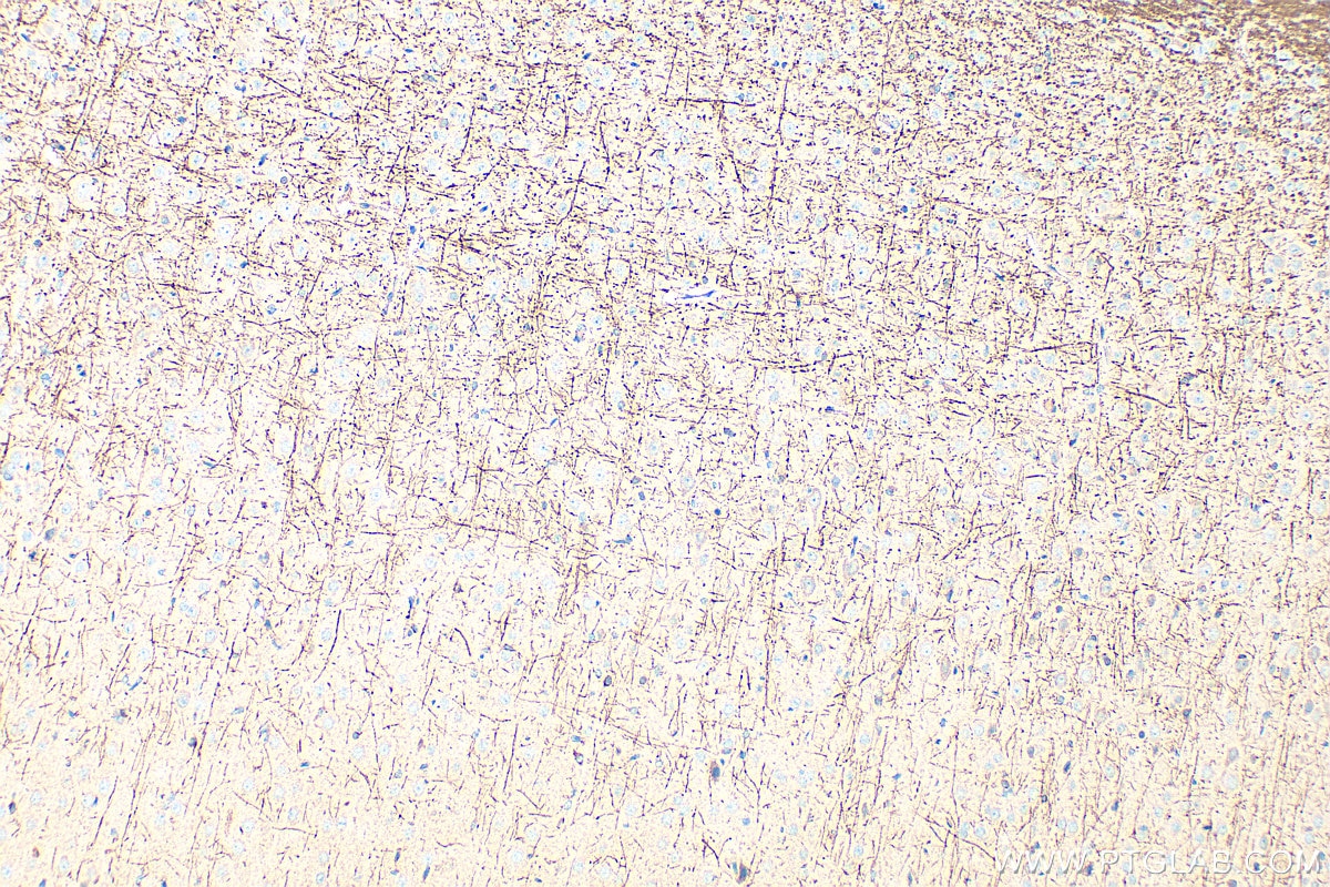 IHC staining of rat brain using 33489-1-AP (same clone as 33489-1-PBS) Immunohistochemistry (IHC) staining of rat brain tissue using PTCHD4 Polyclonal antibody (33489-1-AP)