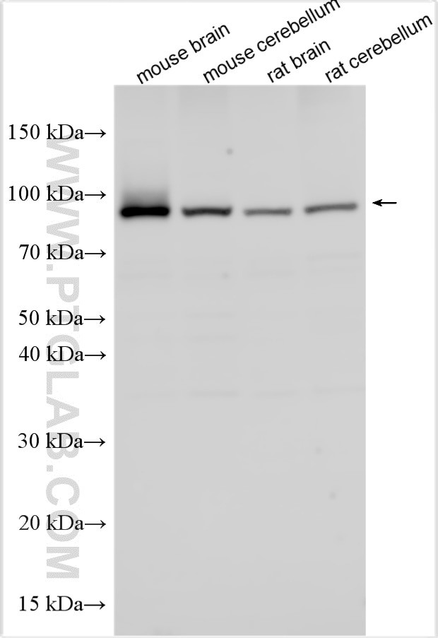 WB analysis using 33489-1-AP (same clone as 33489-1-PBS) Western Blot (WB) analysis of various lysates using PTCHD4 Polyclonal antibody (33489-1-AP)