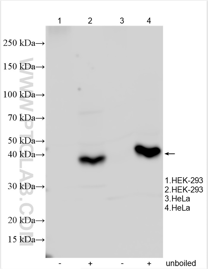 Western Blot (WB) analysis of various lysates using PTDSS1 Polyclonal antibody (20820-1-AP)
