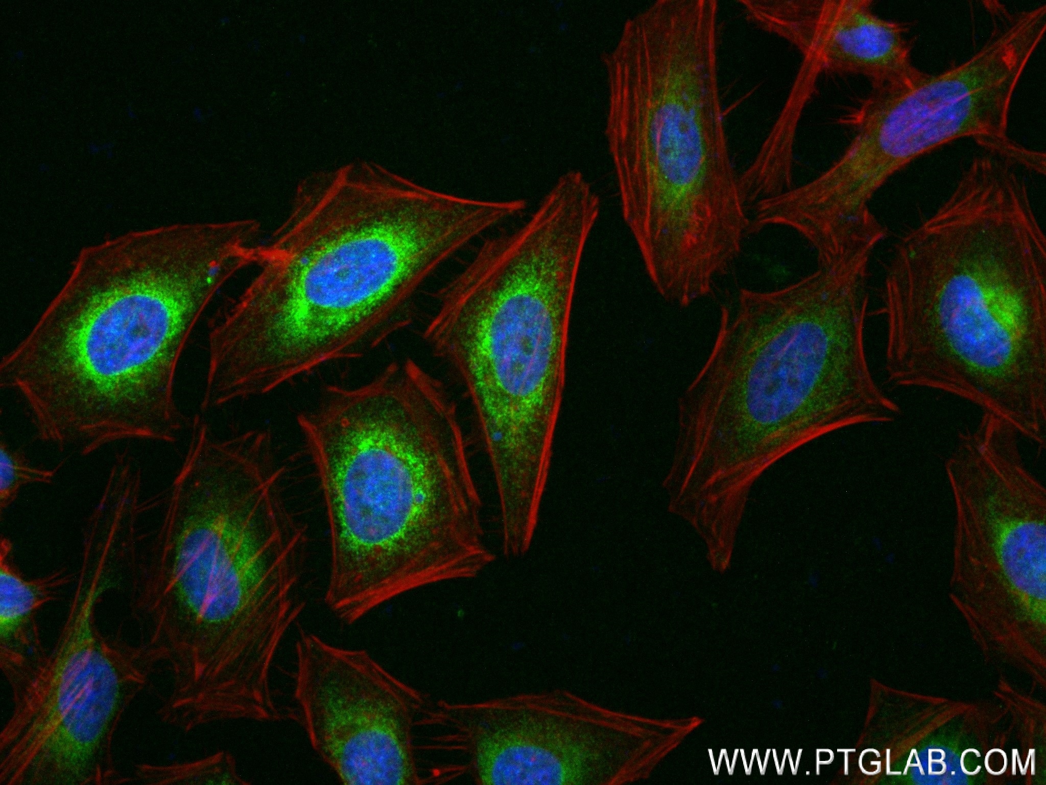 Immunofluorescence (IF) / fluorescent staining of Hela cells using PTDSS1 Recombinant antibody (83421-1-RR)