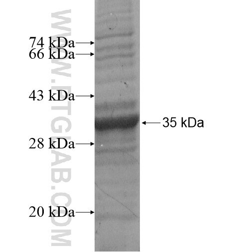 PTDSS1 fusion protein Ag14170 SDS-PAGE