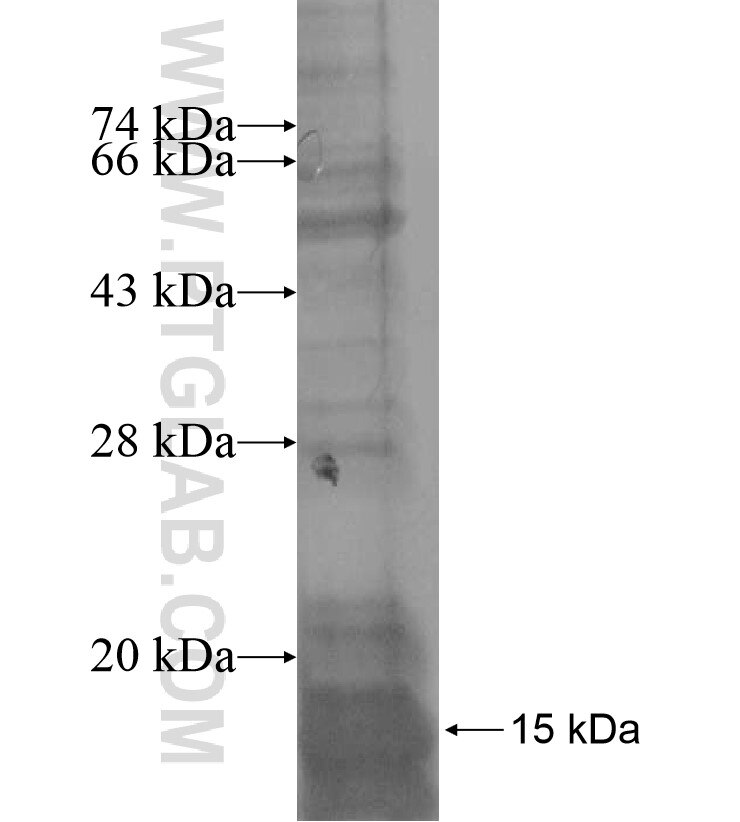 PTDSS1 fusion protein Ag16935 SDS-PAGE