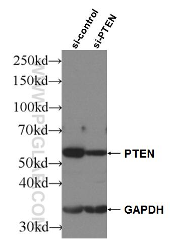 WB analysis of HeLa using 10047-1-AP