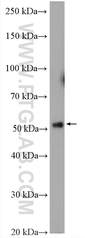 WB analysis of HeLa using 10047-1-AP