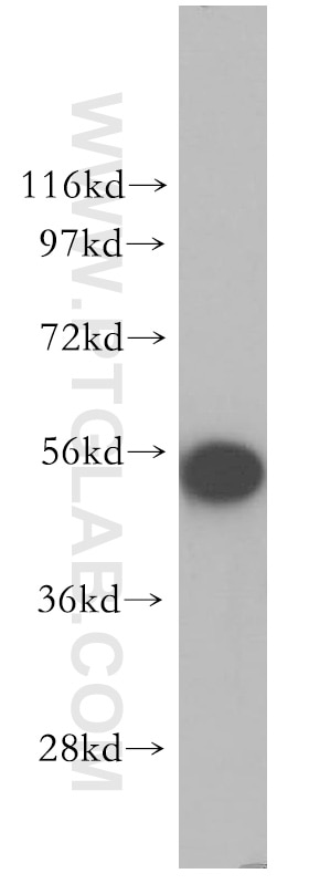 Western Blot (WB) analysis of HeLa cells using PTEN Polyclonal antibody (10047-1-AP)