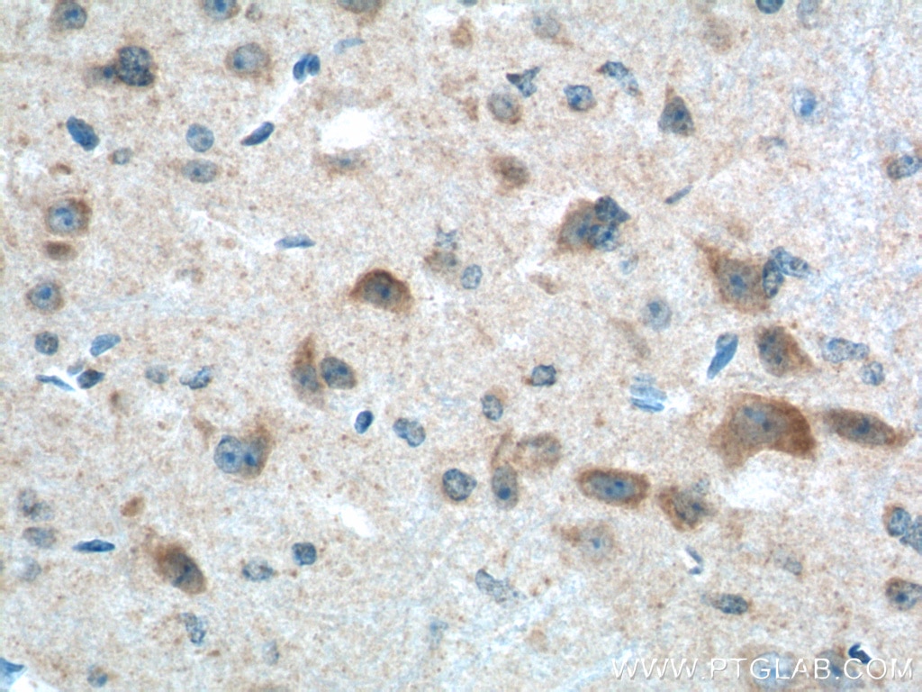 Immunohistochemistry (IHC) staining of mouse brain tissue using PTEN Polyclonal antibody (22034-1-AP)