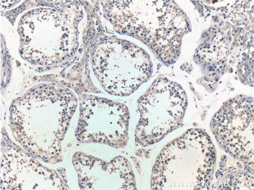 Immunohistochemistry (IHC) staining of human testis tissue using PTEN Polyclonal antibody (22034-1-AP)