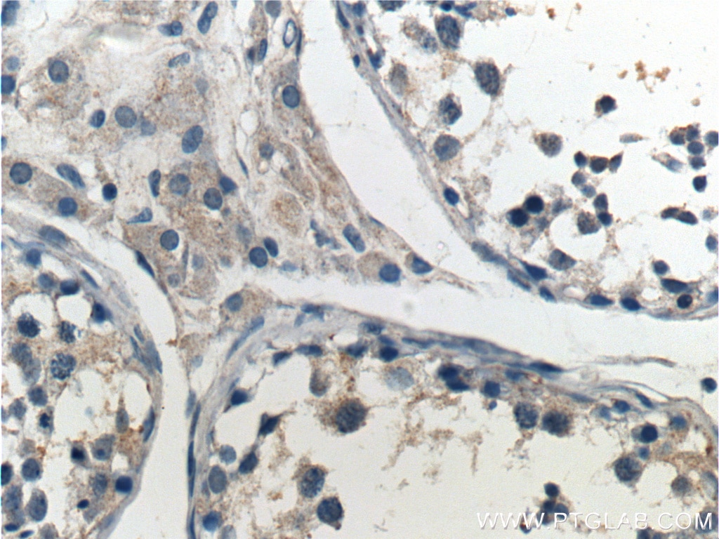 Immunohistochemistry (IHC) staining of human testis tissue using PTEN Polyclonal antibody (22034-1-AP)