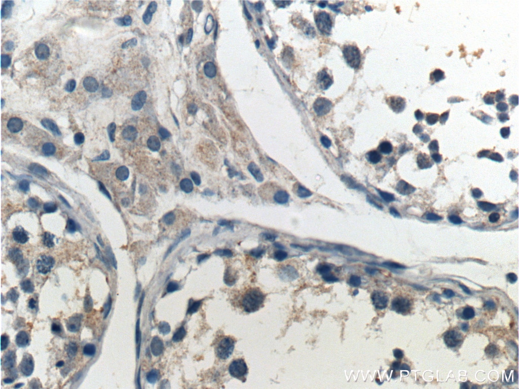 IHC staining of human testis using 22034-1-AP