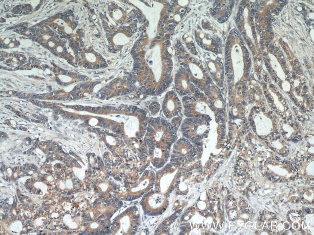 PTEN Polyclonal antibody