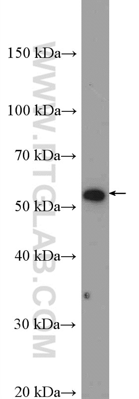 Western Blot (WB) analysis of DU 145 cells using PTEN Polyclonal antibody (22034-1-AP)