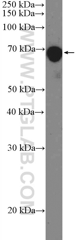 PTEN Polyclonal antibody