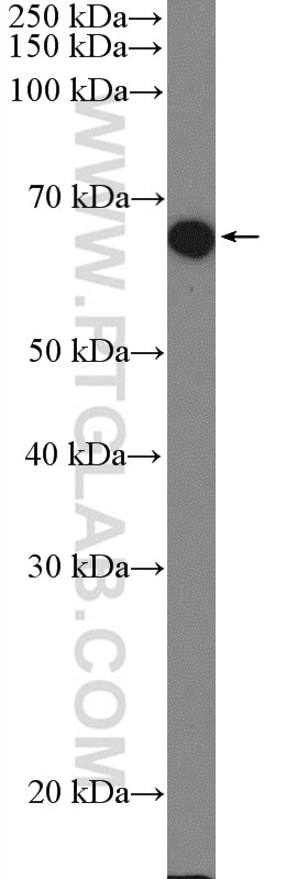 Western Blot (WB) analysis of HeLa cells using PTEN Polyclonal antibody (22034-1-AP)