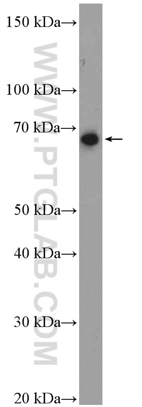 Western Blot (WB) analysis of mouse thymus tissue using PTEN Polyclonal antibody (22034-1-AP)