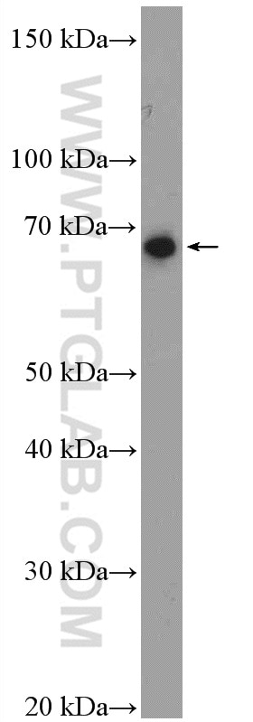 Western Blot (WB) analysis of mouse thymus tissue using PTEN Polyclonal antibody (22034-1-PBS)