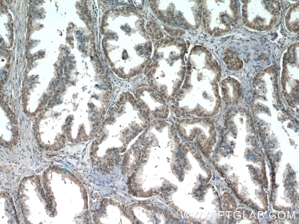 Immunohistochemistry (IHC) staining of human prostate hyperplasia tissue using PTEN Monoclonal antibody (60300-1-Ig)