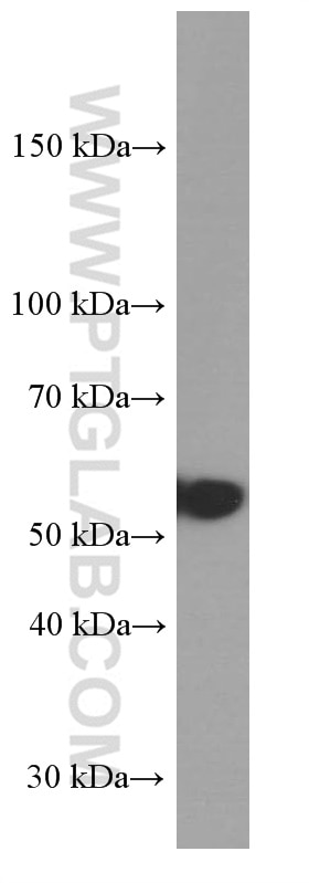 Western Blot (WB) analysis of fetal human brain tissue using PTEN Monoclonal antibody (60300-1-Ig)