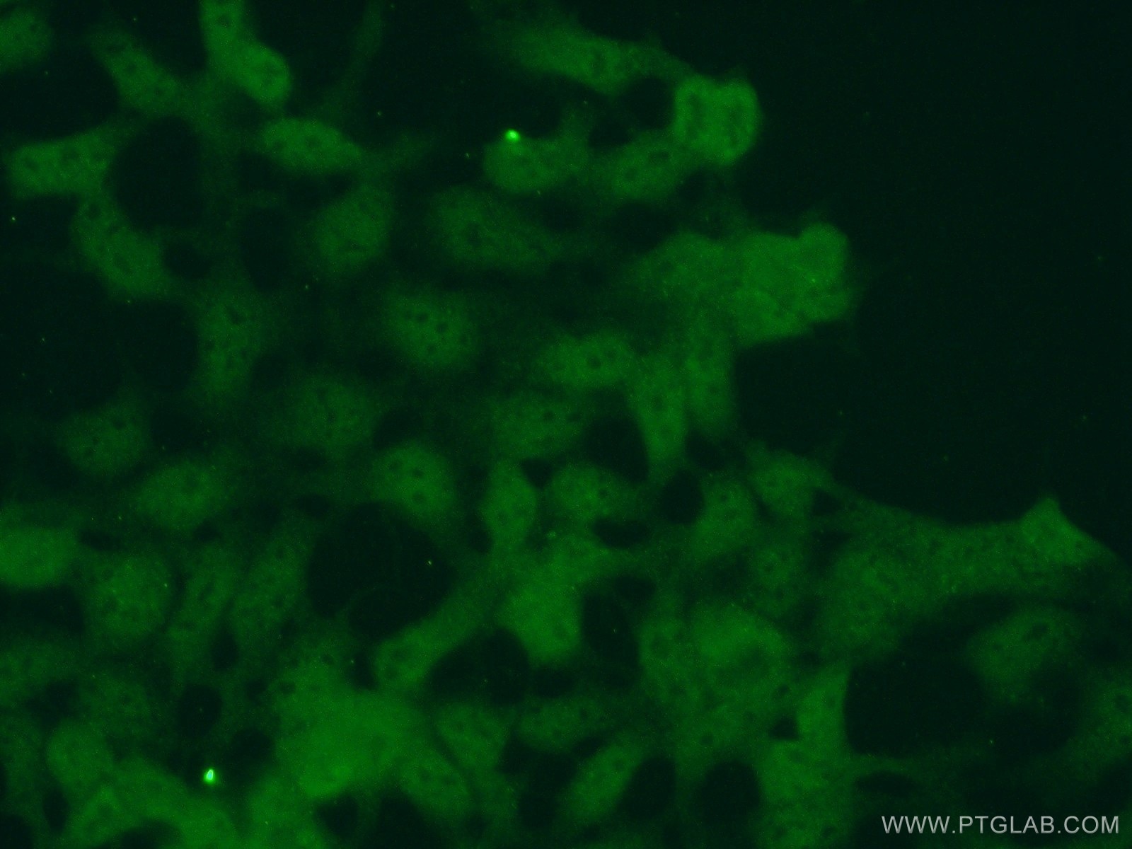 Immunofluorescence (IF) / fluorescent staining of HEK-293 cells using PTER Polyclonal antibody (11191-1-AP)