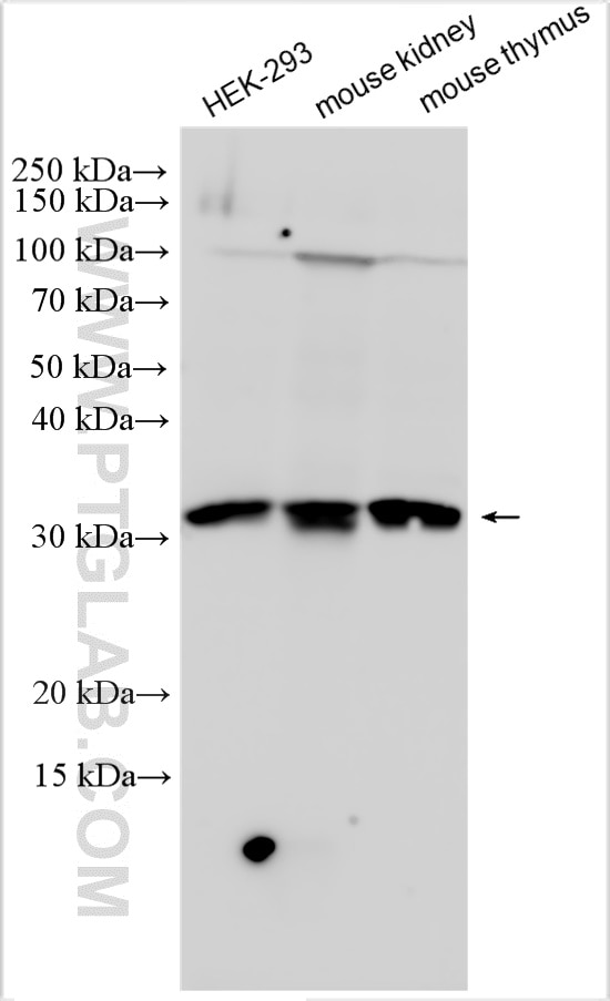 Western Blot (WB) analysis of various lysates using PTER Polyclonal antibody (11191-1-AP)