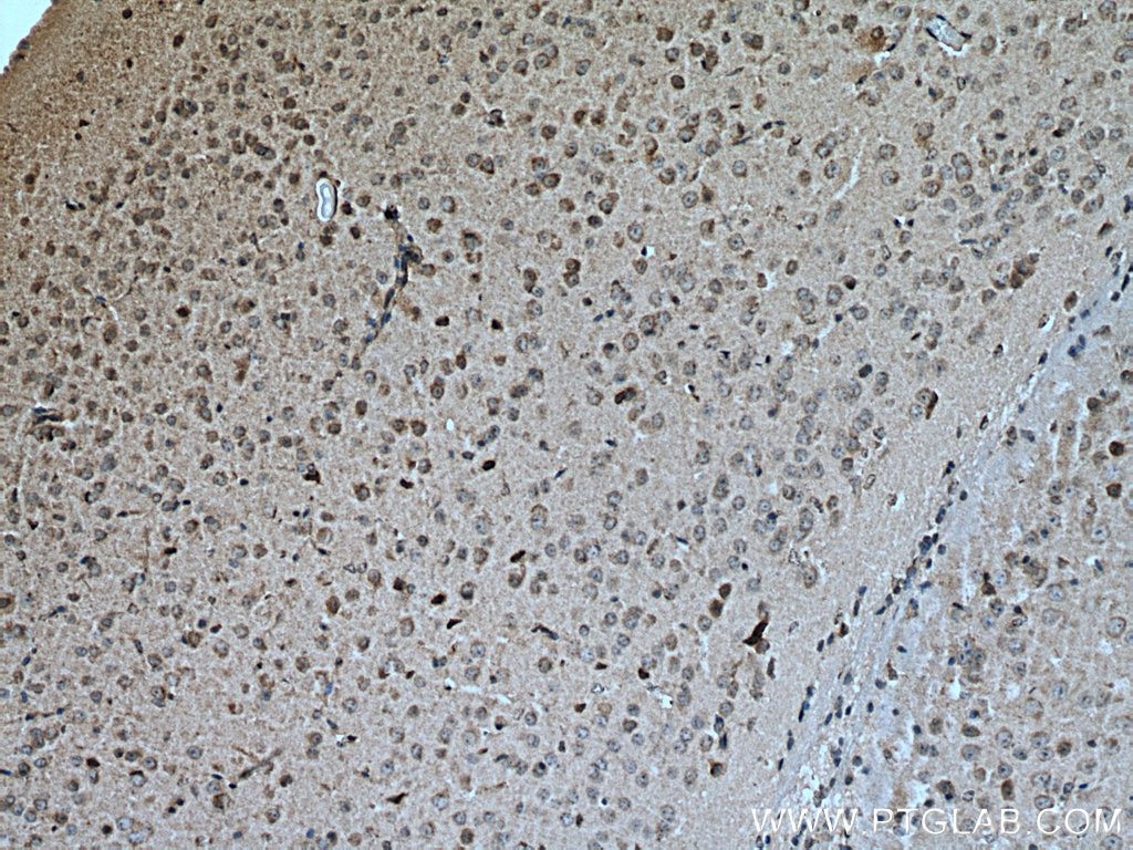 Immunohistochemistry (IHC) staining of mouse brain tissue using PTGDS Polyclonal antibody (10754-2-AP)