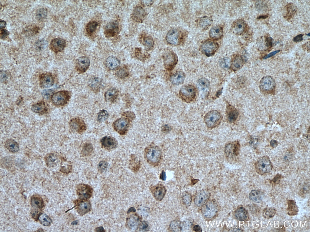 Immunohistochemistry (IHC) staining of mouse brain tissue using PTGDS Polyclonal antibody (10754-2-AP)