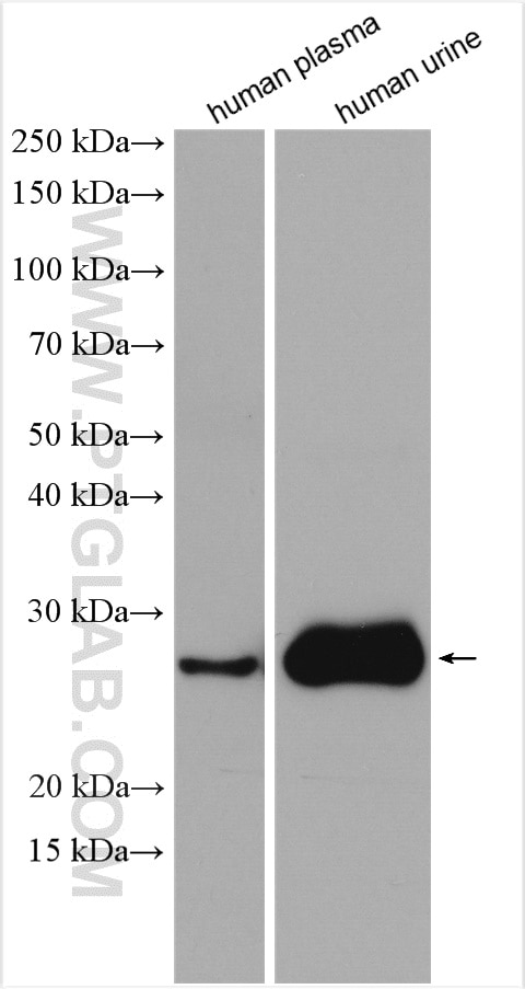 Western Blot (WB) analysis of various lysates using PTGDS Polyclonal antibody (10754-2-AP)