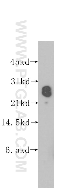 Western Blot (WB) analysis of human kidney tissue using PTGDS Polyclonal antibody (10754-2-AP)